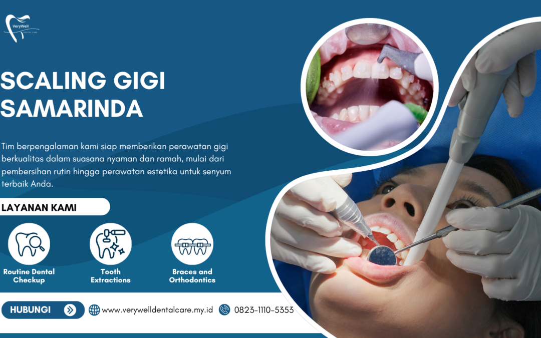 Scaling gigi Samarinda