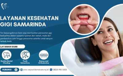 Layanan Kesehatan Gigi Samarinda yang Profesional