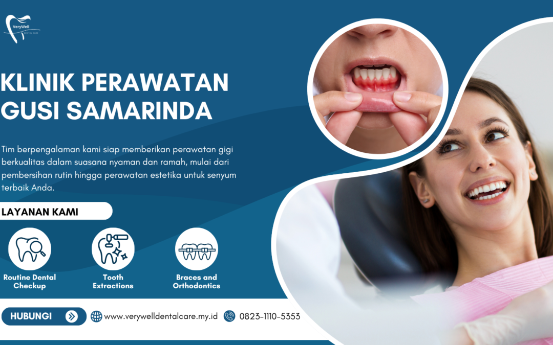 Klinik Perawatan Gusi Samarinda