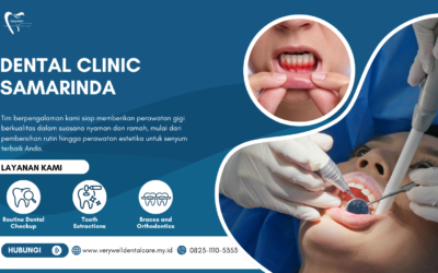 Klinik Gigi Profesional Samarinda dengan Teknologi Modern