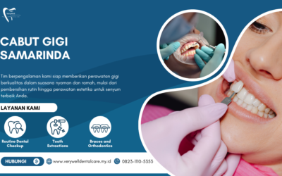 Cabut Gigi Samarinda Aman dengan Pemeriksaan Dokter
