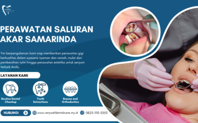 Perawatan Saluran Akar Samarinda untuk Menjaga Gigi