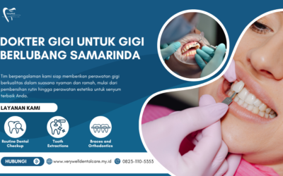 Dokter Gigi untuk Gigi Berlubang Samarinda yang Tepat