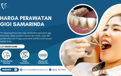 Harga Perawatan Gigi Samarinda Panduan Biaya Lengkap
