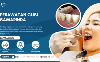 Perawatan Gusi Samarinda untuk Gusi Sehat dan Kuat